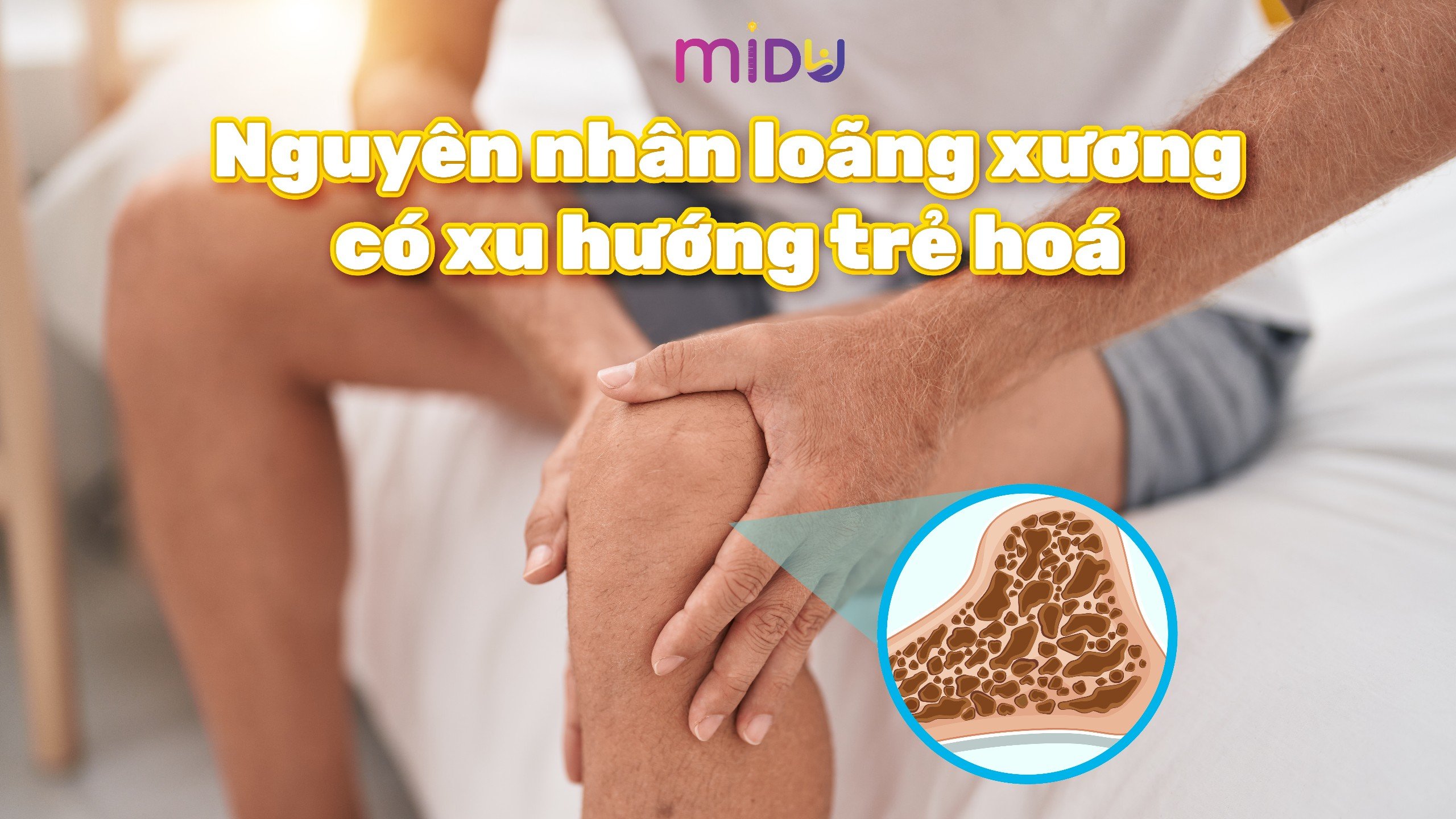 Nguyên nhân loãng xương có xu hướng trẻ hóa